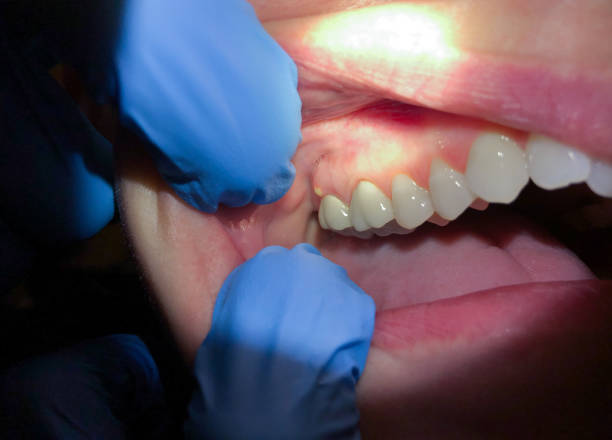 Best Same-Day Emergency Dentist in Suffolk, VA