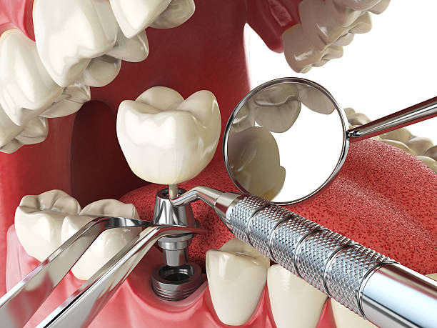 Best Walk-In Emergency Dentist in Suffolk, VA